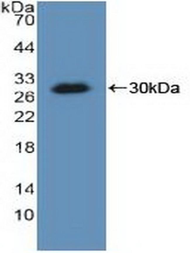 KARS Antibody in Western Blot (WB)