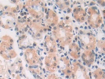 MIF Antibody in Immunohistochemistry (Paraffin) (IHC (P))