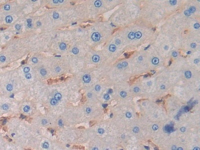 HLA-C Antibody in Immunohistochemistry (Paraffin) (IHC (P))