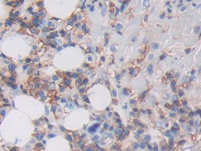 HLA-C Antibody in Immunohistochemistry (Paraffin) (IHC (P))