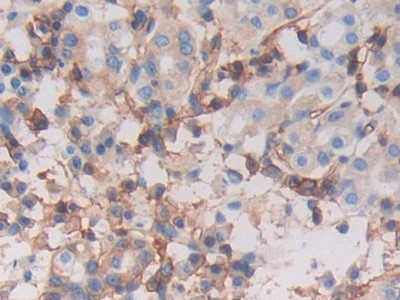 HLA-C Antibody in Immunohistochemistry (Paraffin) (IHC (P))