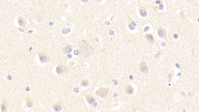 MPI Antibody in Immunohistochemistry (Paraffin) (IHC (P))