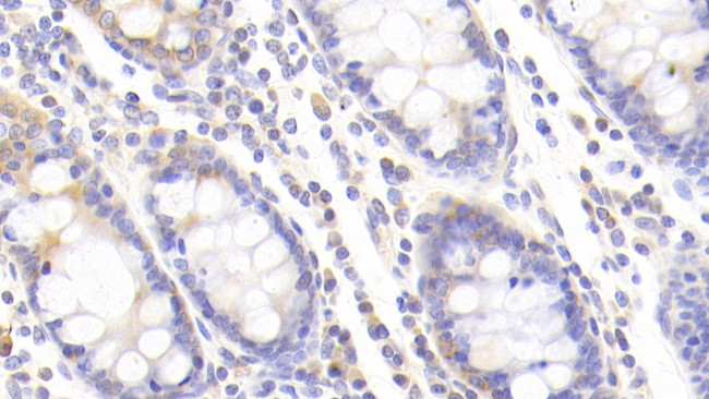 MPI Antibody in Immunohistochemistry (Paraffin) (IHC (P))