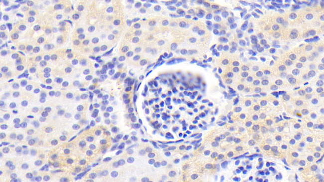 MPI Antibody in Immunohistochemistry (Paraffin) (IHC (P))