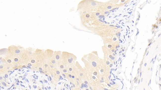 MMP13 Antibody in Immunohistochemistry (Paraffin) (IHC (P))