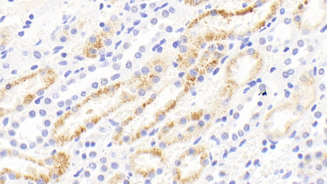 MMP13 Antibody in Immunohistochemistry (Paraffin) (IHC (P))