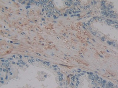 MMP14 Antibody in Immunohistochemistry (Paraffin) (IHC (P))