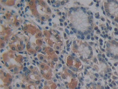 MMP14 Antibody in Immunohistochemistry (Paraffin) (IHC (P))