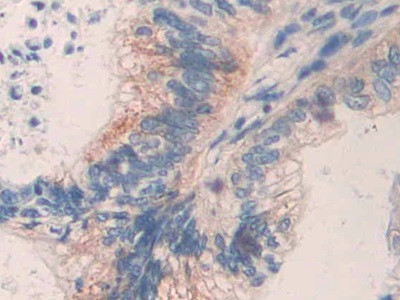 MMP24 Antibody in Immunohistochemistry (Paraffin) (IHC (P))