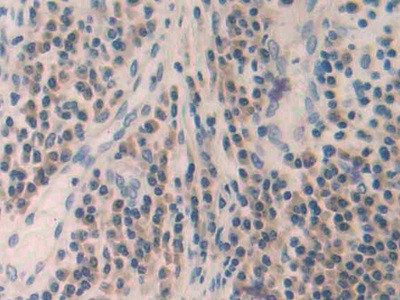 MMP24 Antibody in Immunohistochemistry (Paraffin) (IHC (P))