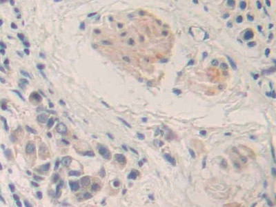 MMP24 Antibody in Immunohistochemistry (Paraffin) (IHC (P))