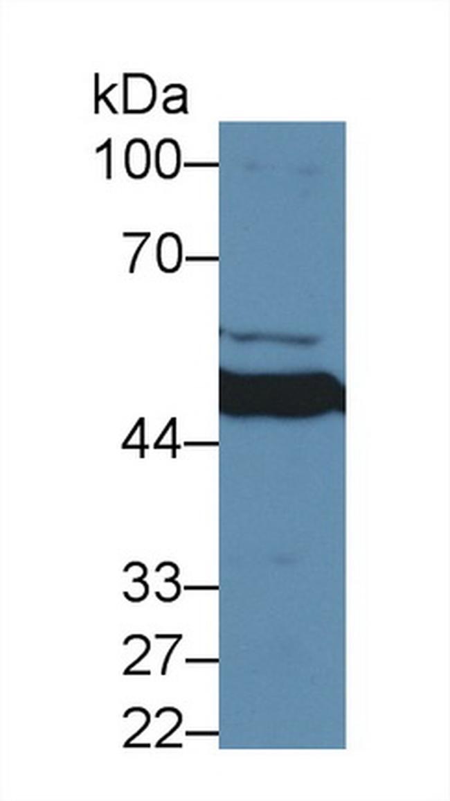 MMP24 Antibody in Western Blot (WB)