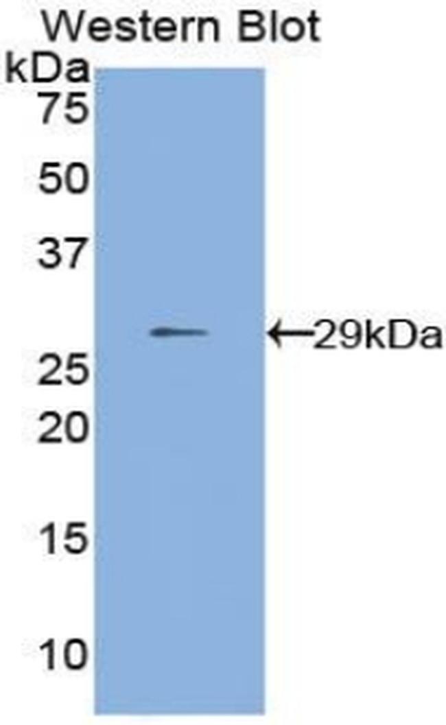 MMP24 Antibody in Western Blot (WB)