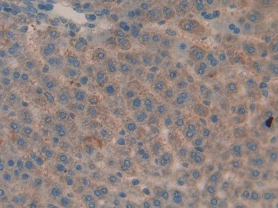 MMP9 Antibody in Immunohistochemistry (Paraffin) (IHC (P))