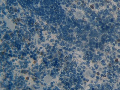 MMP9 Antibody in Immunohistochemistry (Paraffin) (IHC (P))