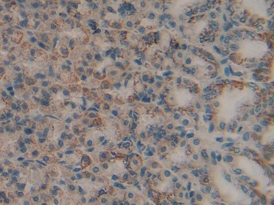 MMP9 Antibody in Immunohistochemistry (Paraffin) (IHC (P))