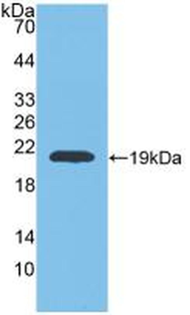 MMP9 Antibody in Western Blot (WB)