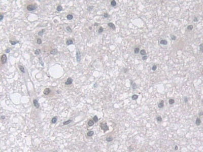 MPP5 Antibody in Immunohistochemistry (Paraffin) (IHC (P))