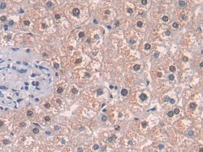 MAT2A Antibody in Immunohistochemistry (Paraffin) (IHC (P))