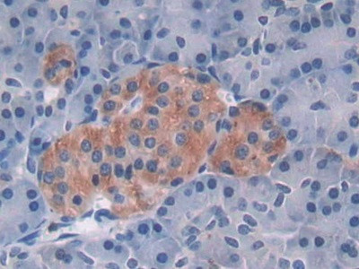 MAT2A Antibody in Immunohistochemistry (Paraffin) (IHC (P))