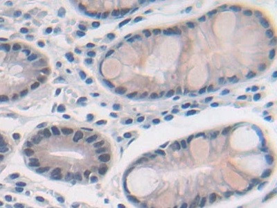 MAT2A Antibody in Immunohistochemistry (Paraffin) (IHC (P))