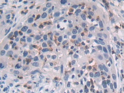 MAT2A Antibody in Immunohistochemistry (Paraffin) (IHC (P))