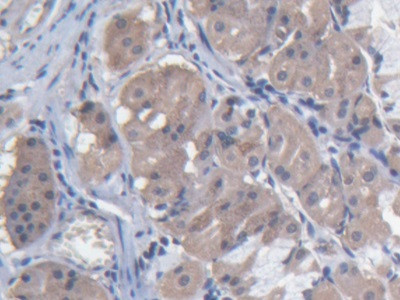 MARS Antibody in Immunohistochemistry (Paraffin) (IHC (P))