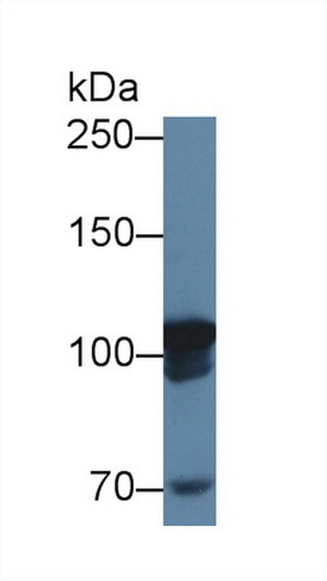 MARS Antibody in Western Blot (WB)