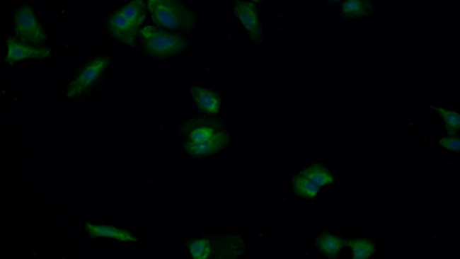 MEK2 Antibody in Immunocytochemistry (ICC/IF)