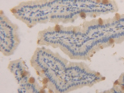 MUC2 Antibody in Immunohistochemistry (Paraffin) (IHC (P))