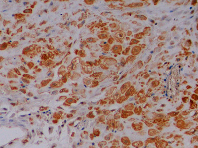 MUC2 Antibody in Immunohistochemistry (Paraffin) (IHC (P))