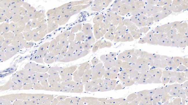 MYH7 Antibody in Immunohistochemistry (Paraffin) (IHC (P))