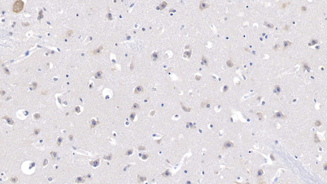 MYH7 Antibody in Immunohistochemistry (Paraffin) (IHC (P))