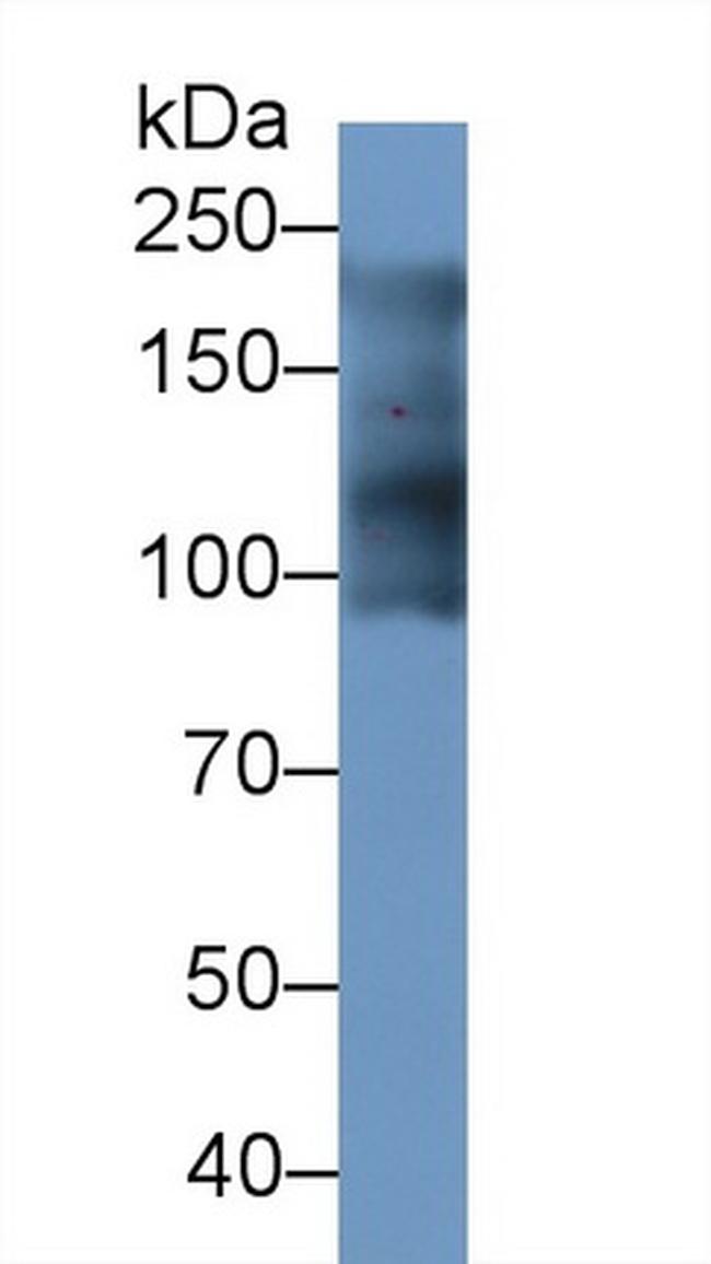 MYH7 Antibody in Western Blot (WB)