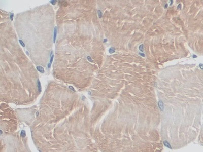 MYO1D Antibody in Immunohistochemistry (Paraffin) (IHC (P))