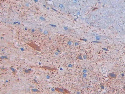 Myostatin Antibody in Immunohistochemistry (Paraffin) (IHC (P))