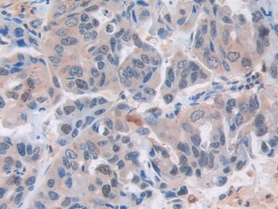 MX1 Antibody in Immunohistochemistry (Paraffin) (IHC (P))