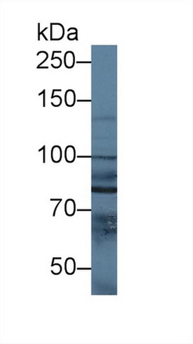 NAGLU Antibody in Western Blot (WB)