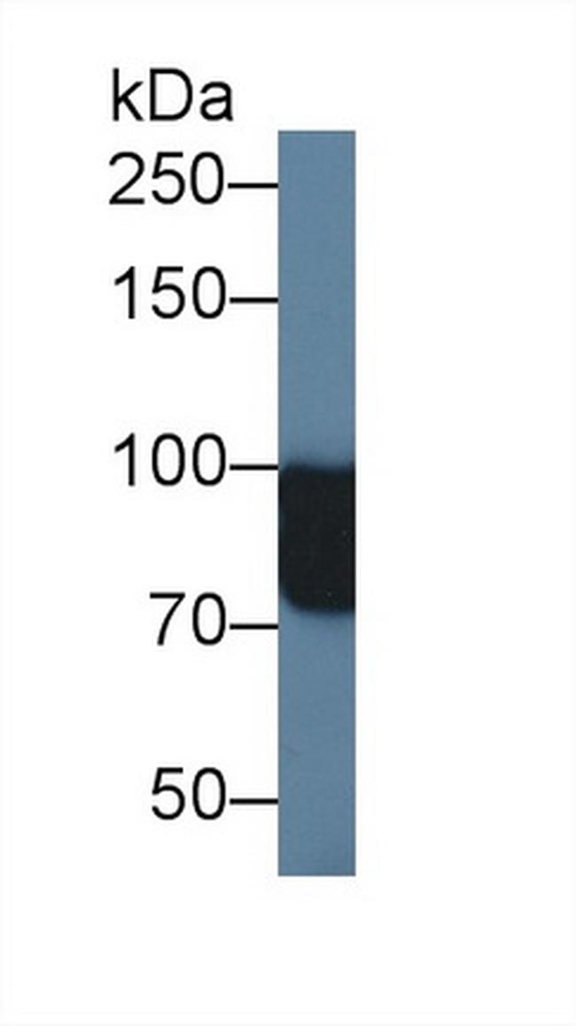 NAGLU Antibody in Western Blot (WB)