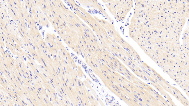 NDUFS1 Antibody in Immunohistochemistry (Paraffin) (IHC (P))