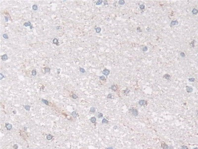 NDUFS1 Antibody in Immunohistochemistry (Paraffin) (IHC (P))