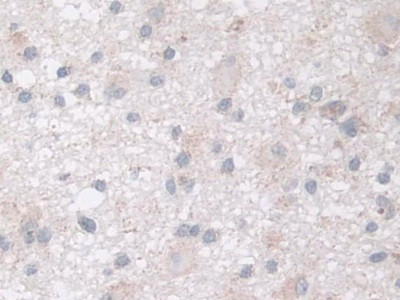 NDUFS1 Antibody in Immunohistochemistry (Paraffin) (IHC (P))