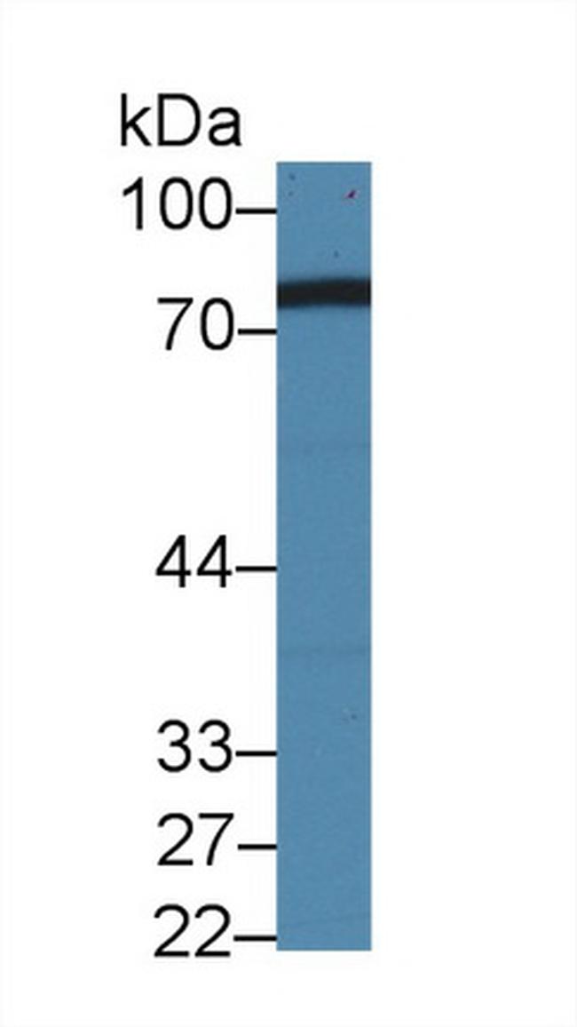 NDUFS1 Antibody in Western Blot (WB)