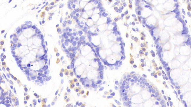 CD336 (NKp44) Antibody in Immunohistochemistry (Paraffin) (IHC (P))