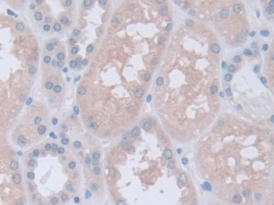 INVS Antibody in Immunohistochemistry (Paraffin) (IHC (P))