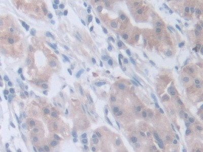 INVS Antibody in Immunohistochemistry (Paraffin) (IHC (P))