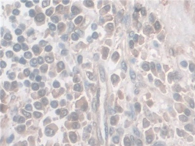 Nesprin 2 Antibody in Immunohistochemistry (Paraffin) (IHC (P))