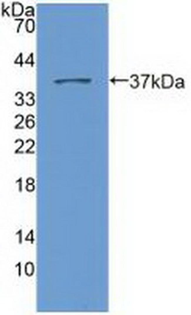 Nesprin 2 Antibody in Western Blot (WB)