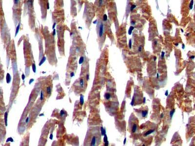 Nexilin Antibody in Immunohistochemistry (Paraffin) (IHC (P))