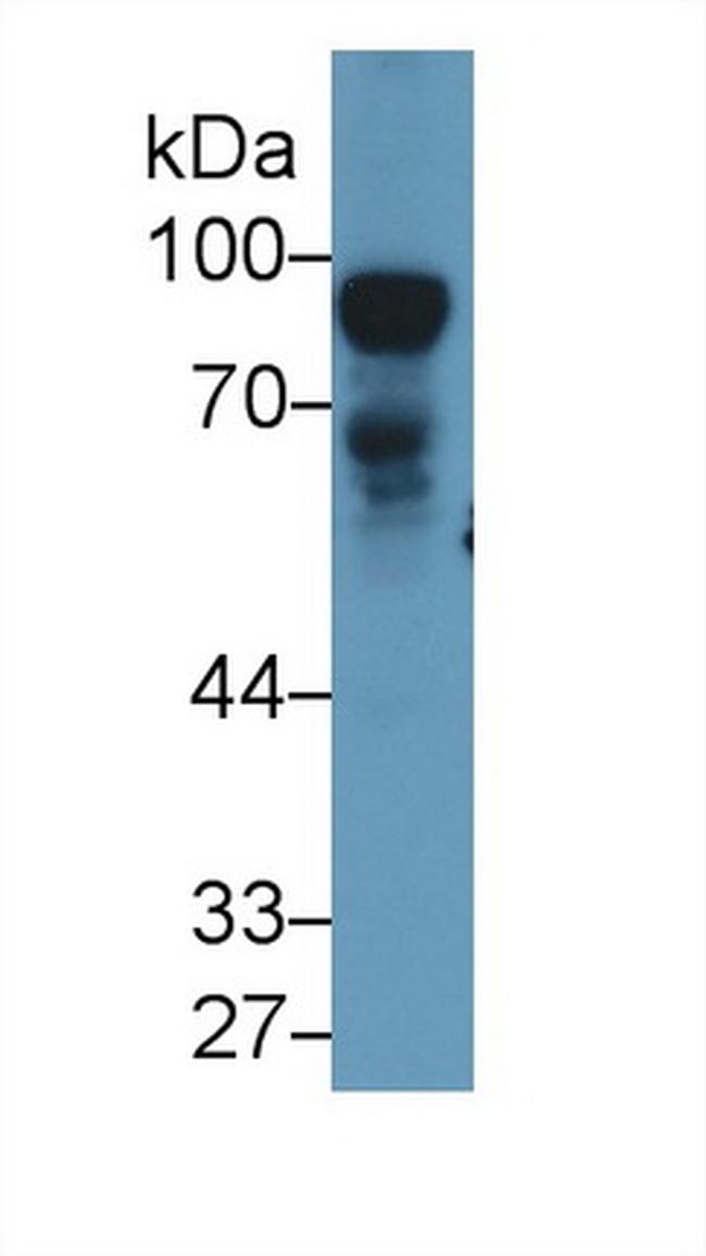 Nexilin Antibody in Western Blot (WB)